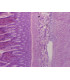 Intestino grueso s.t.