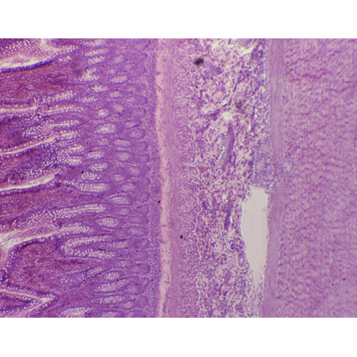 Intestino grueso s.t.