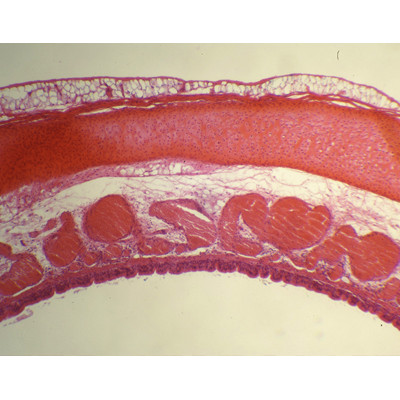 Traqueia, s.t.