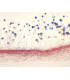 Aspergillus, e.i.