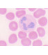 Extensión de sangre humana