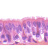 Epitelio ciliado sec.
