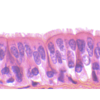 Epitelio ciliado sec.