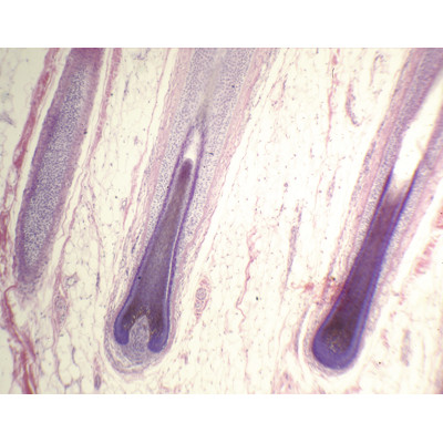 Cuero cabelludo humano CT (folículos pilosos, glándulas sebáceas)