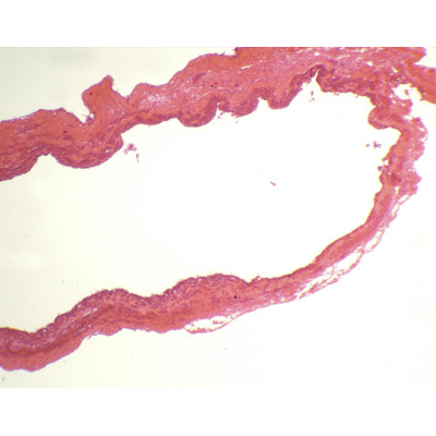 Veia s.t. (ratazana, coelho ou ovelha )