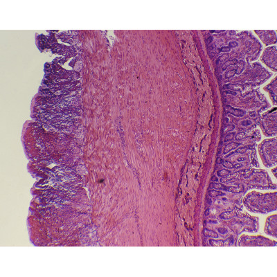Intestino delgado s.t.