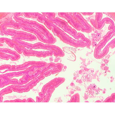 Intestino grueso dse rana, sec.