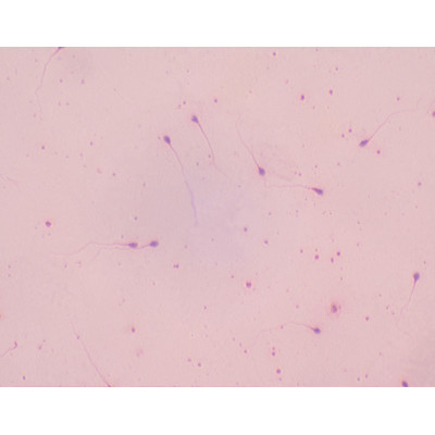 Esperma humano, frotis (giemsa)