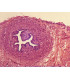 Trompa de falópio s.t.