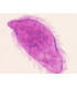 Miracidio de Schistosoma, m.e.