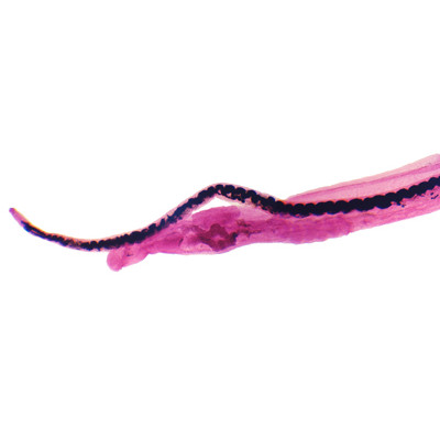 Conjugación Schistosoma macho-hembra, m.e.