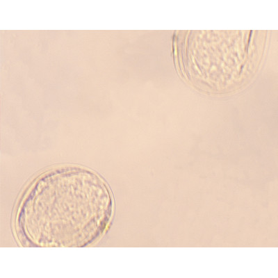 Huevos de Schistosoma, m.e.