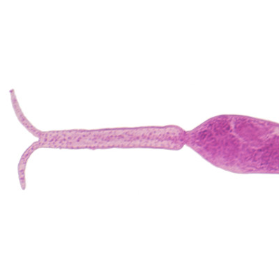 Cercaria de Schistosoma, m.e.