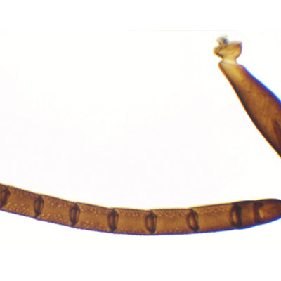 Antena de abeja, m.e.