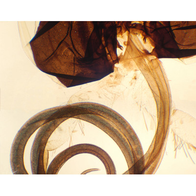 Apto. bucal mariposa, m.e.