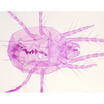 Tetranychus telarius (ácaro vermelho comum), e.i.