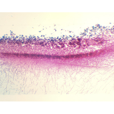Penicillium, conidióforos