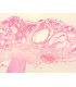 Órgão reprodutor masculino de Marchantia, s.l.