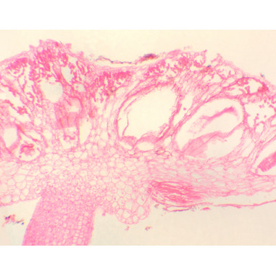 Órgano reproductor masculino de Marchantia, s.l.