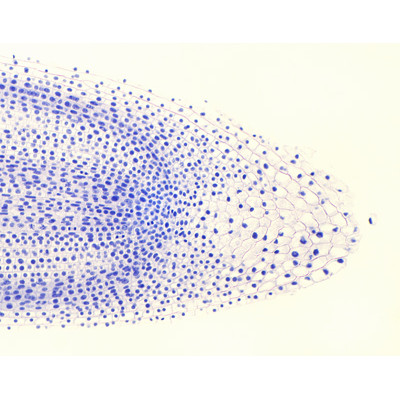 Mitosis de punta de raíz de cebolla, s.l.