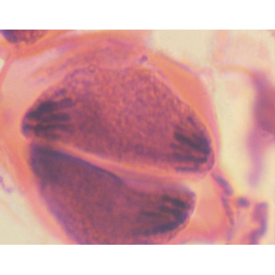 Meiosis en antera de lirio, s.t.