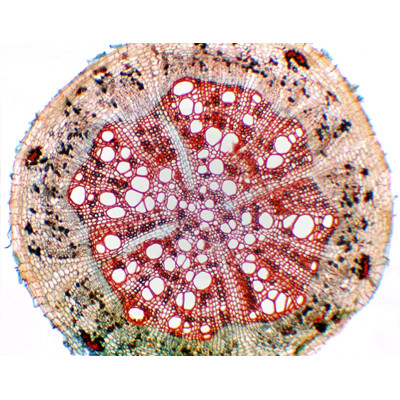 Raíz de Glycine max, s.t.