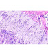 Osificación endocondral