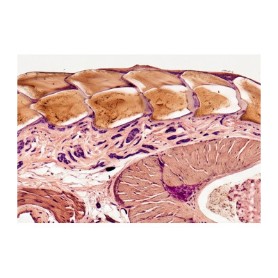 Piel reptil CT