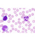 Sangue de ratazana