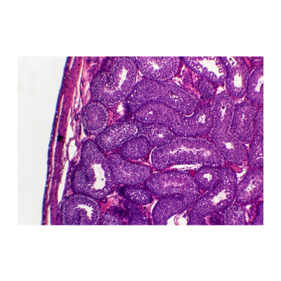 Testículo s.t. (ratazana) (Hematoxilina)