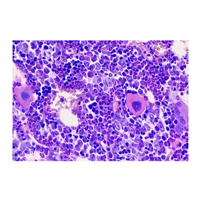 Médula CT (rata, conejo o vaca)