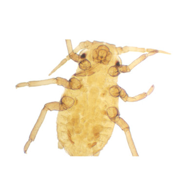 Pulgón (áfido) alado