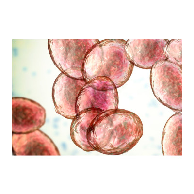 Levedura de cerveja (Saccharomyces), esfregaço.