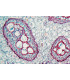 Peciolo de feto s.t.