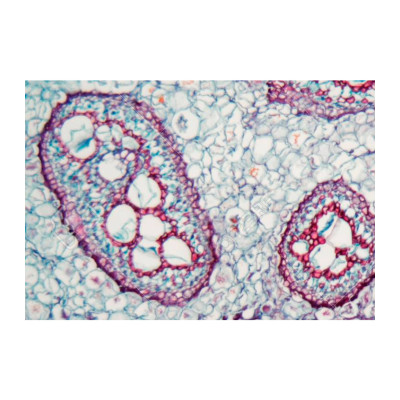 Peciolo de helecho CT