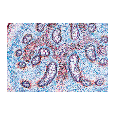 Rizoma de helecho ( polypodium) CT