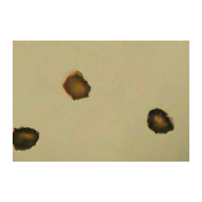 Esporangios CT hoja de Lengua de ciervo (escolopendra).