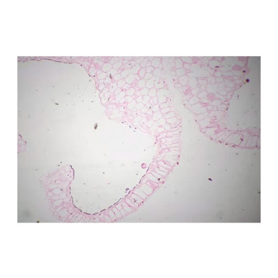 Anteras maduras
