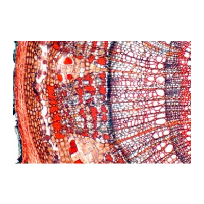 Caule de Pyrus (peral), s.t.