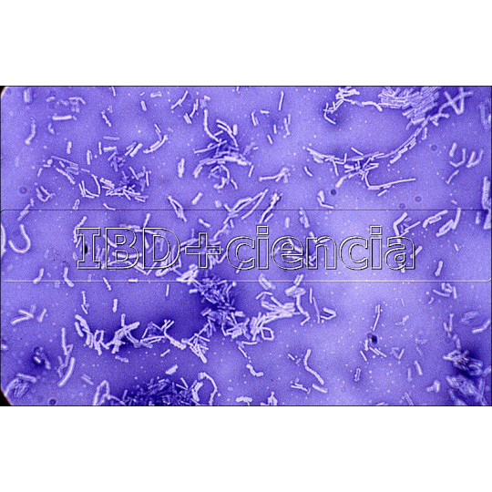 COLECCIÓN BACTERIAS Y LEVADURAS. MICROORGANISMOS.12 PREPARACIONES