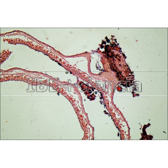 COLECCIÓN HONGOS, LÍQUENES Y MUSGOS. 12 PREPARACIONES