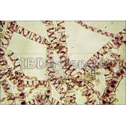 COLECCIÓN DE 12 PREPARACIONES ESTRUCTURA CELULAR