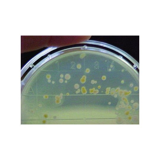 PLACAS PETRI CON AGAR NUTRITIVO PLACAS PETRI CON AGAR NUTRITIVO