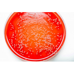 PLACAS PETRI COM AGAR SANGUE