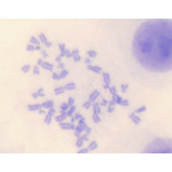 Cromossomas humanos em sangue masculino e feminino