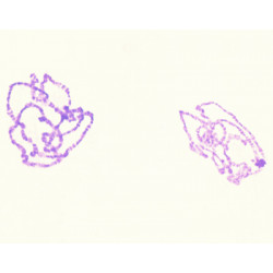 Cromosomas gigantes de glándula salival