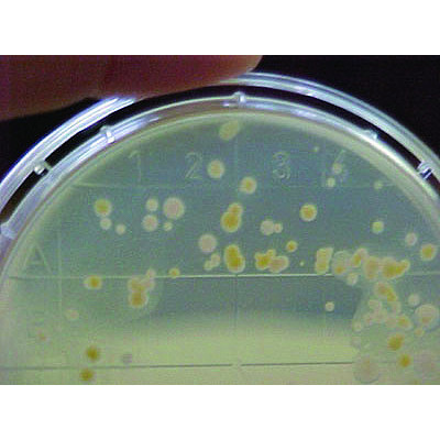 AGAR HEKTOEN 10 placas