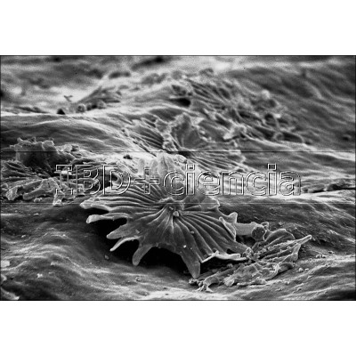 Andesito (Martinica)