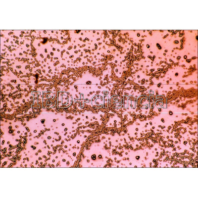 Fusión de pronucleos en Áscaris