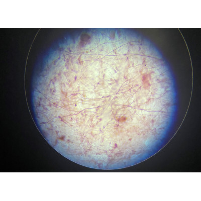 TEJIDO CONJUNTIVO CON CARTÍLAGO HIALINO MAMÍFERO